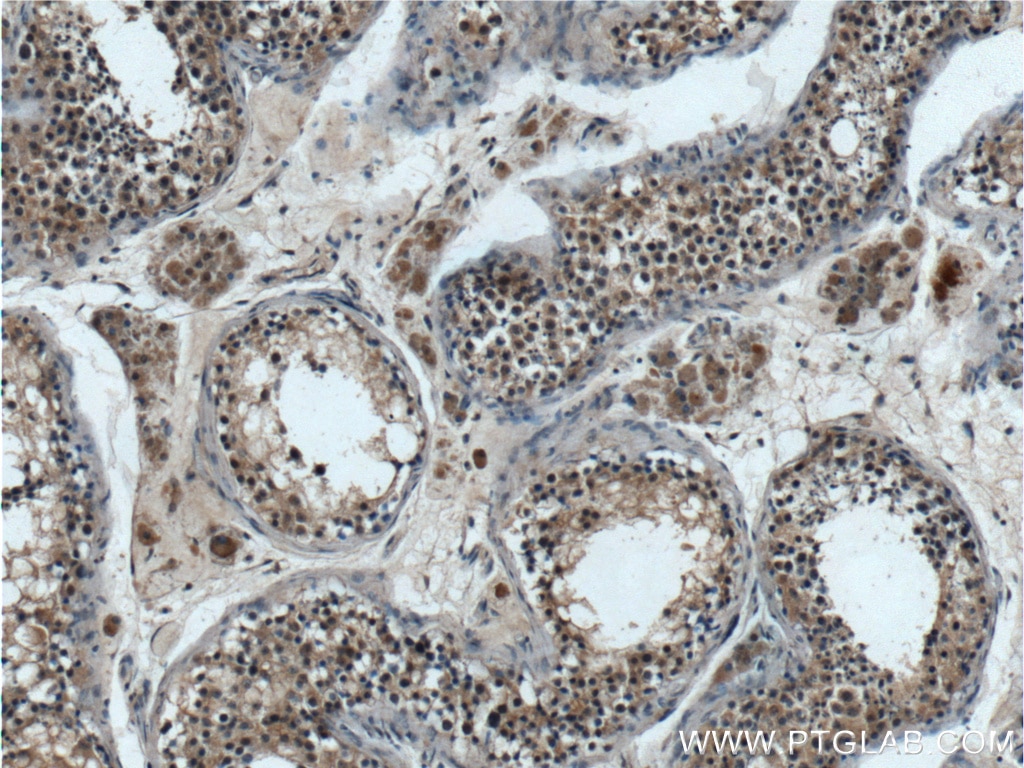 Immunohistochemistry (IHC) staining of human testis tissue using TPRX1 Polyclonal antibody (25834-1-AP)