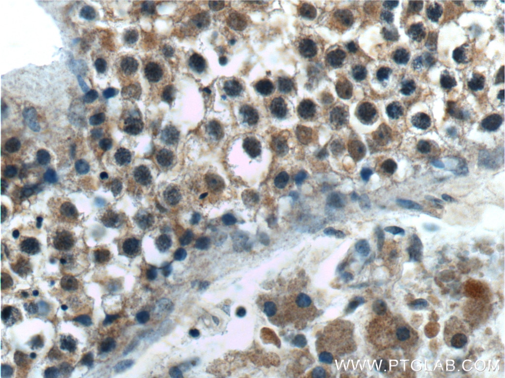Immunohistochemistry (IHC) staining of human testis tissue using TPRX1 Polyclonal antibody (25834-1-AP)