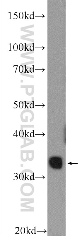Western Blot (WB) analysis of fetal human brain tissue using TPRX1 Polyclonal antibody (25834-1-AP)