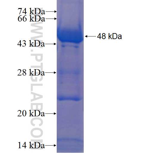 TPRX1 fusion protein Ag23015 SDS-PAGE