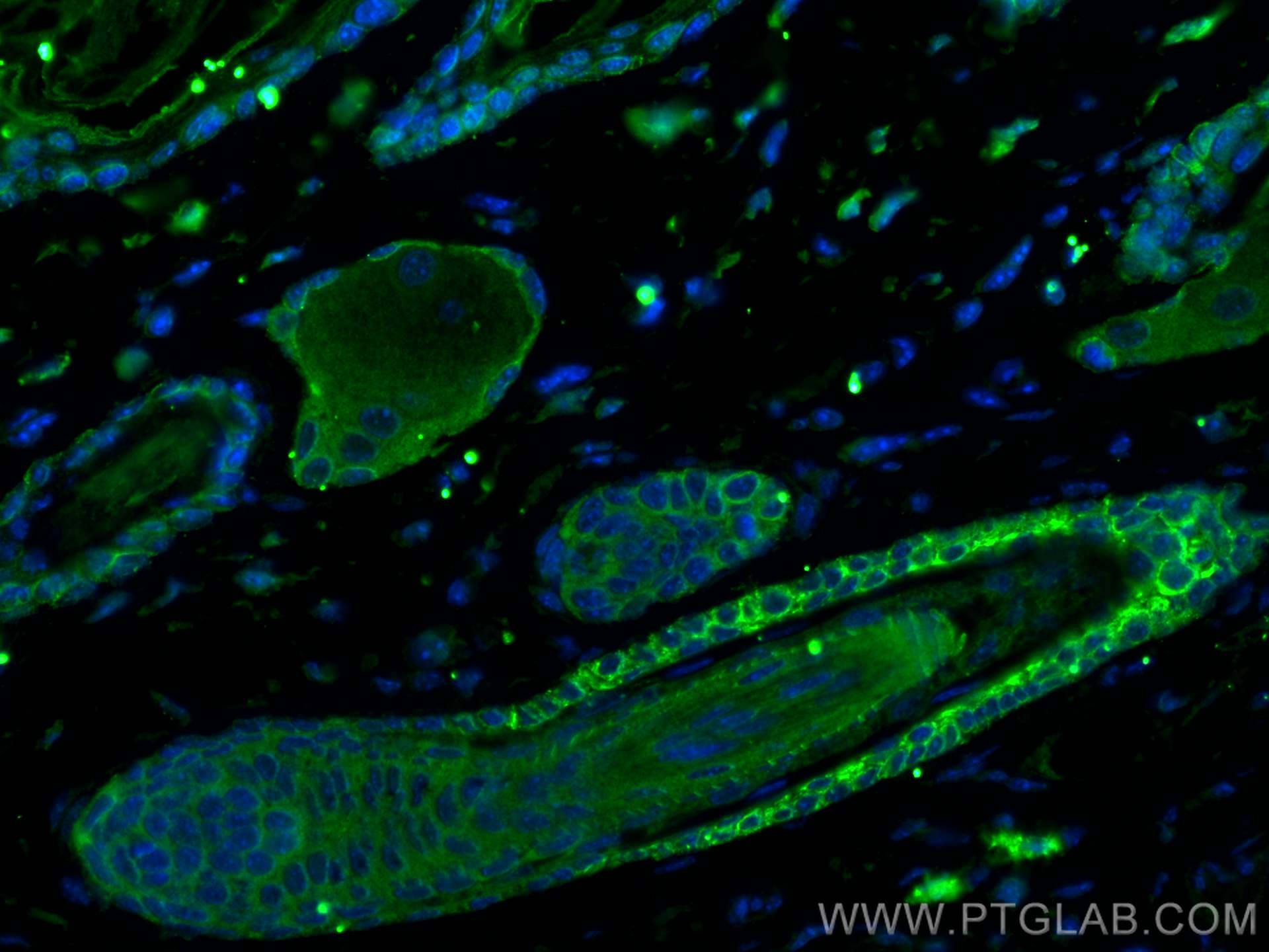 Immunofluorescence (IF) / fluorescent staining of mouse skin tissue using TPSAB1 Polyclonal antibody (13343-1-AP)