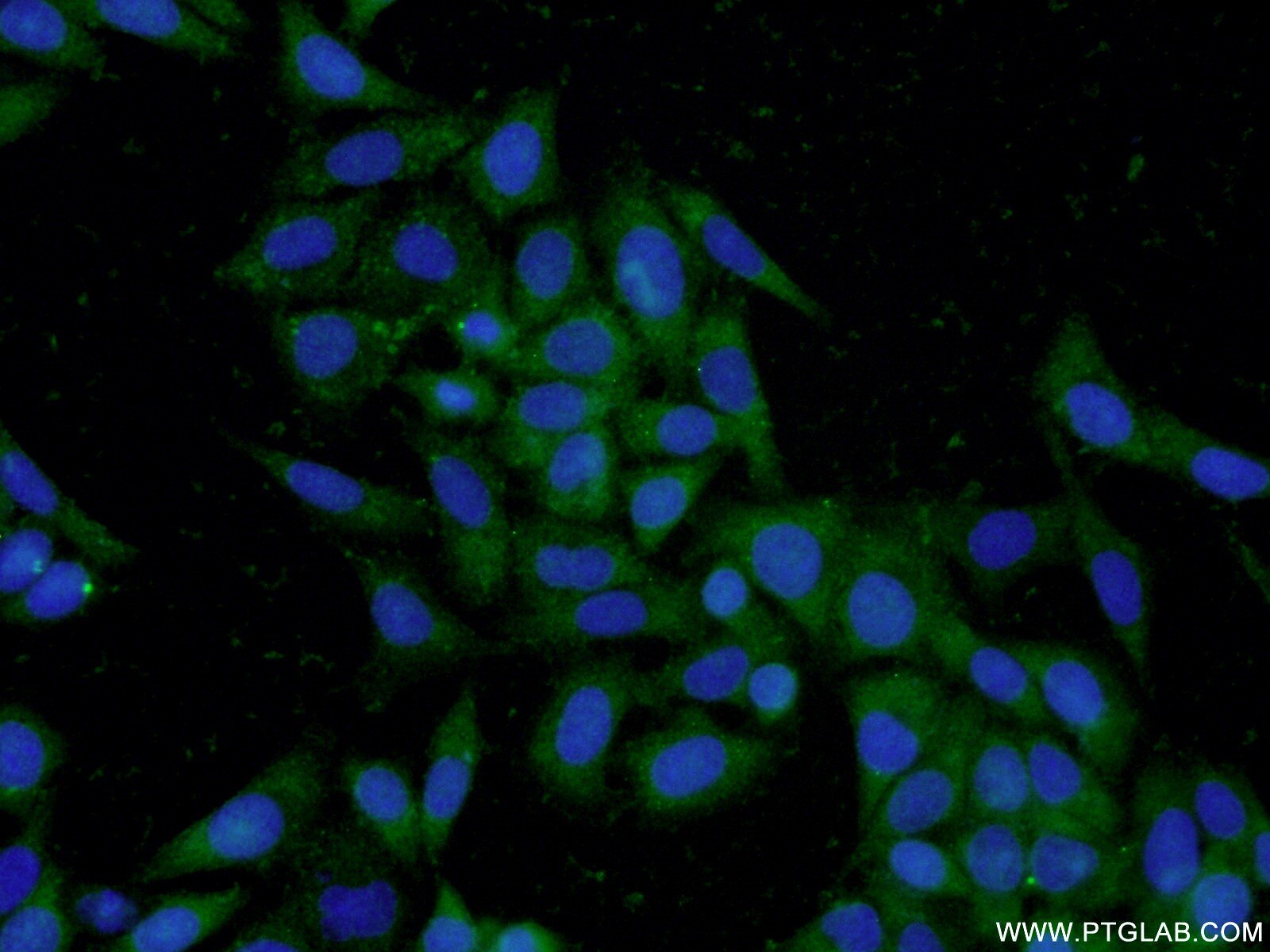 Immunofluorescence (IF) / fluorescent staining of HepG2 cells using TPSAB1 Polyclonal antibody (13343-1-AP)