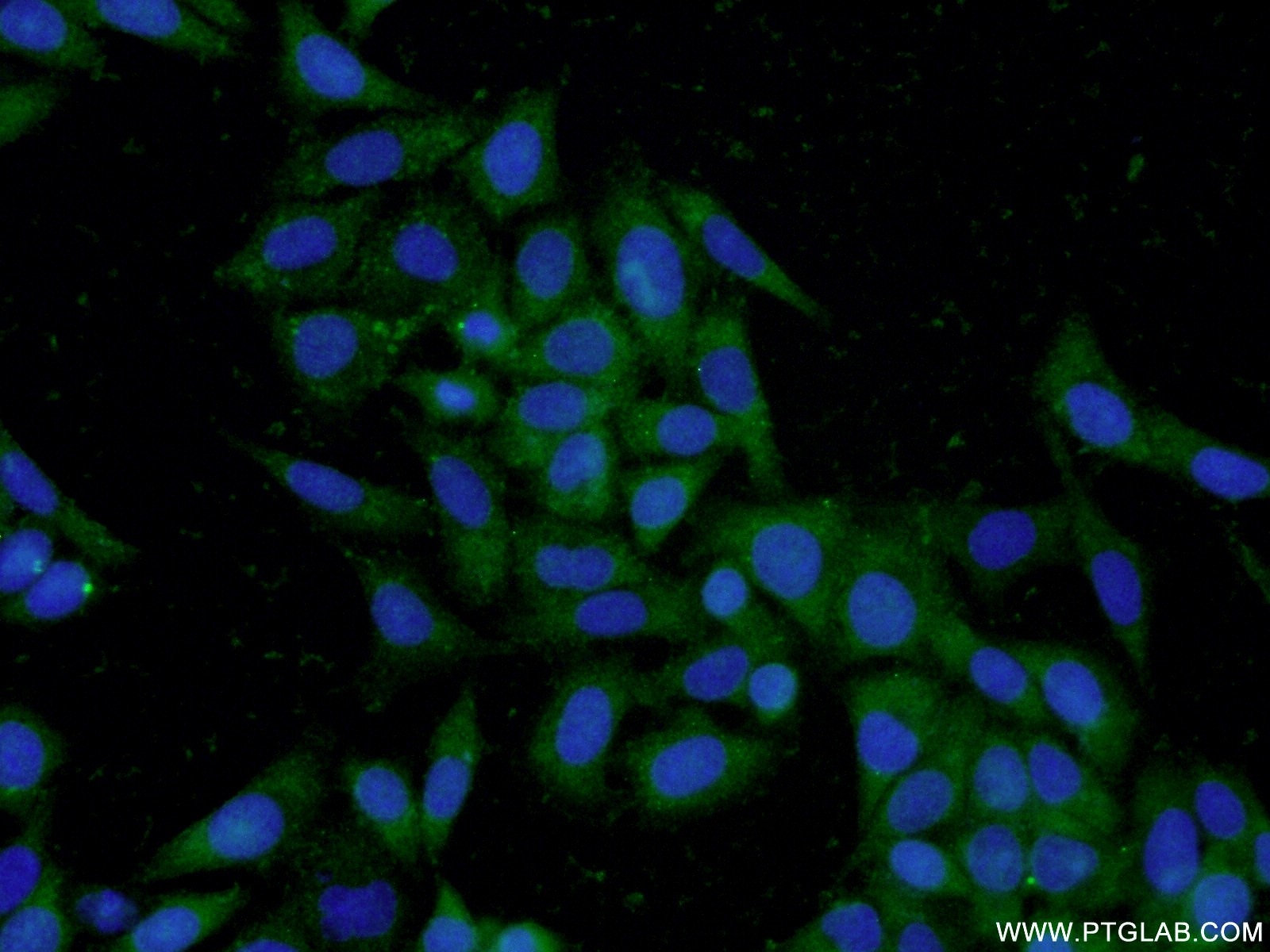 Immunofluorescence (IF) / fluorescent staining of HepG2 cells using TPSAB1 Polyclonal antibody (13343-1-AP)