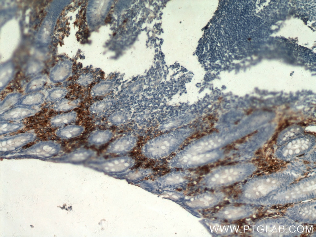 Immunohistochemistry (IHC) staining of human appendix tissue using TPSAB1 Polyclonal antibody (13343-1-AP)