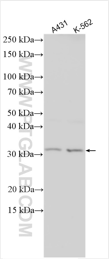 Western Blot (WB) analysis of A431 cells using TPSAB1 Polyclonal antibody (13343-1-AP)