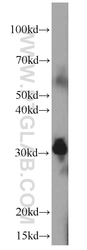 Western Blot (WB) analysis of human kidney tissue using TPSAB1 Monoclonal antibody (66174-1-Ig)