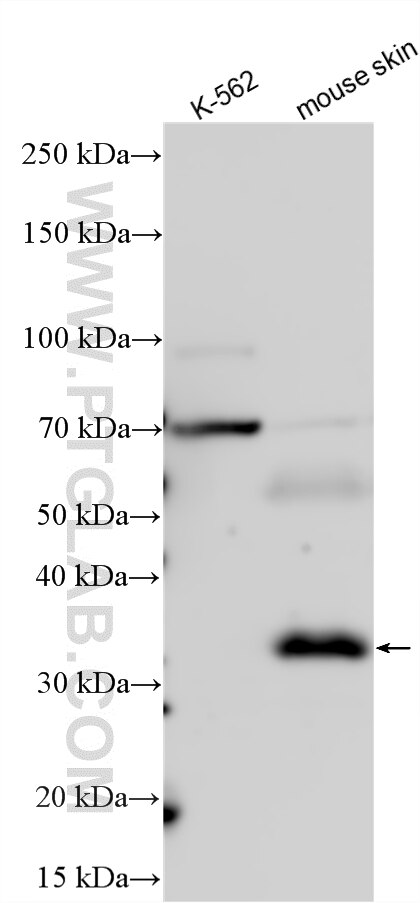 Various lysates were subjected to SDS PAGE followed by western blot with 15332-1-AP (TPSB2 antibody) at dilution of 1:2000 incubated at room temperature for 1.5 hours. TPSB2 deficient cell line K-562 served as a negative control. Western Blot (WB) analysis of various lysates using TPSB2 Polyclonal antibody (15332-1-AP)