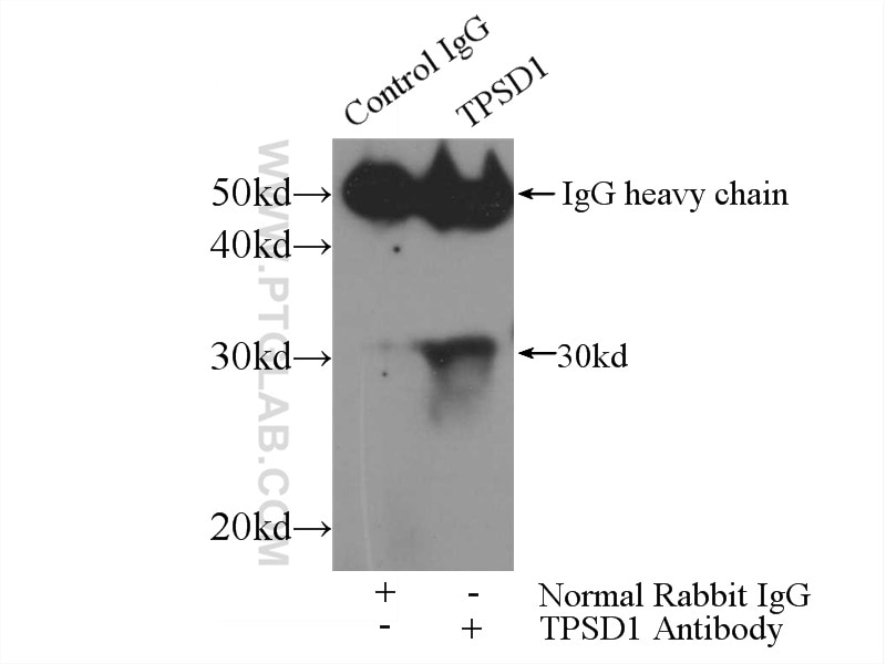 Immunoprecipitation (IP) experiment of A549 cells using TPSD1 Polyclonal antibody (55239-1-AP)