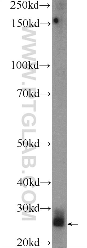 WB analysis of mouse lung using 55239-1-AP