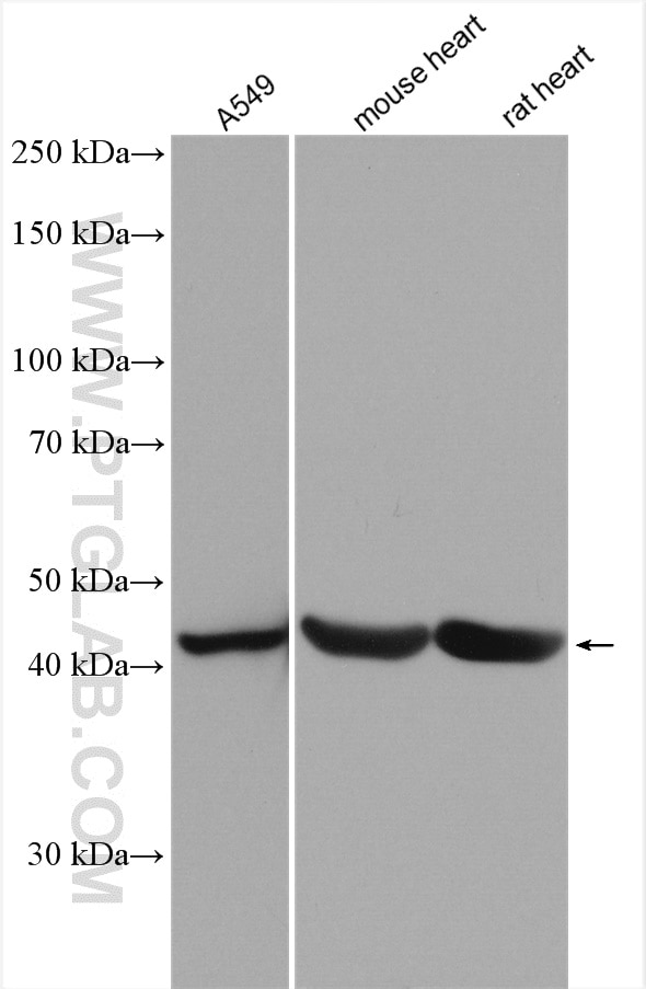Western Blot (WB) analysis of various lysates using TPST1 Polyclonal antibody (12404-1-AP)