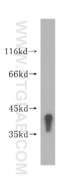Western Blot (WB) analysis of human liver tissue using TPST2 Polyclonal antibody (11699-1-AP)