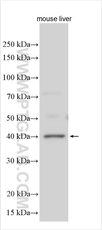 Western Blot (WB) analysis of various lysates using TPST2 Polyclonal antibody (30426-1-AP)