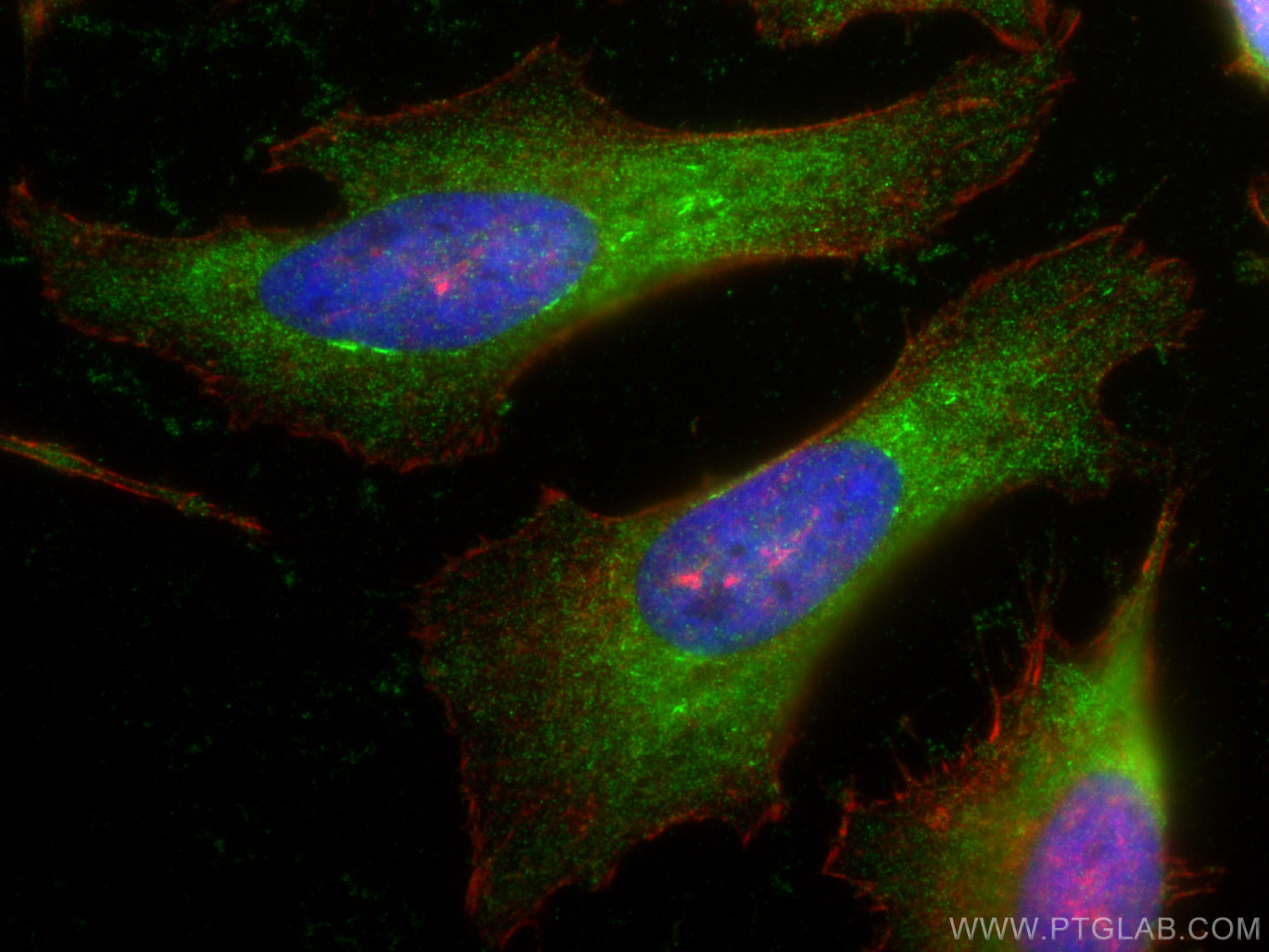 Immunofluorescence (IF) / fluorescent staining of HeLa cells using TPT1 Polyclonal antibody (10824-1-AP)