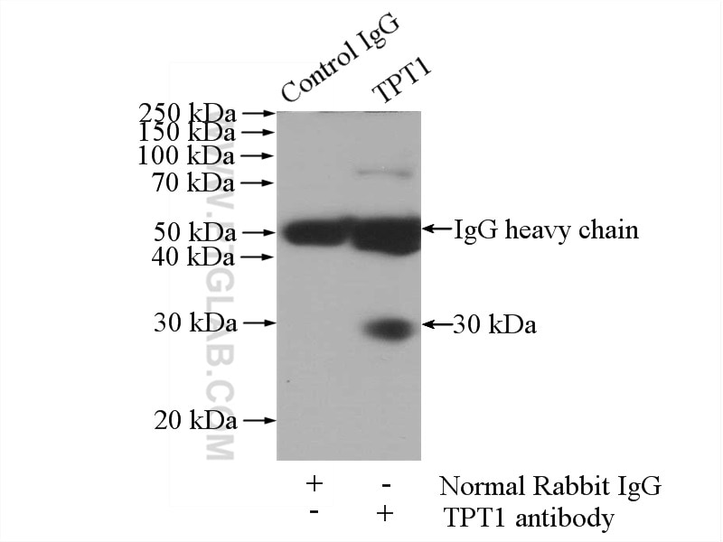 Immunoprecipitation (IP) experiment of human placenta tissue using TPT1 Polyclonal antibody (10824-1-AP)