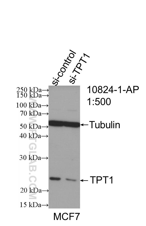 Western Blot (WB) analysis of MCF-7 cells using TPT1 Polyclonal antibody (10824-1-AP)