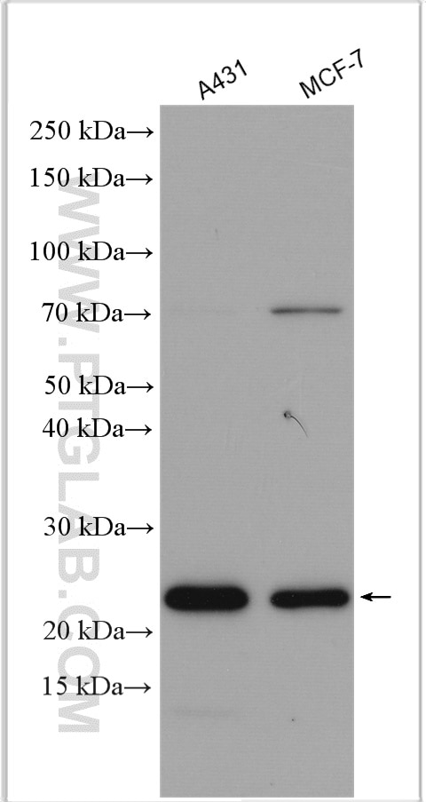 Western Blot (WB) analysis of various lysates using TPT1 Polyclonal antibody (10824-1-AP)
