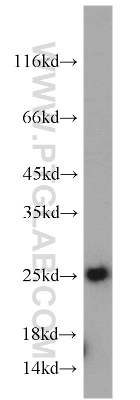 Western Blot (WB) analysis of mouse placenta tissue using TPT1 Polyclonal antibody (10824-1-AP)