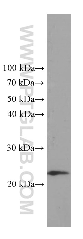 Western Blot (WB) analysis of RAW 264.7 cells using TPT1 Monoclonal antibody (66713-1-Ig)