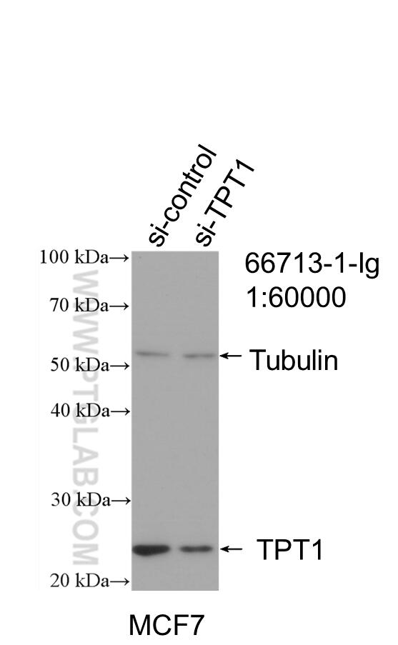 Western Blot (WB) analysis of MCF-7 cells using TPT1 Monoclonal antibody (66713-1-Ig)