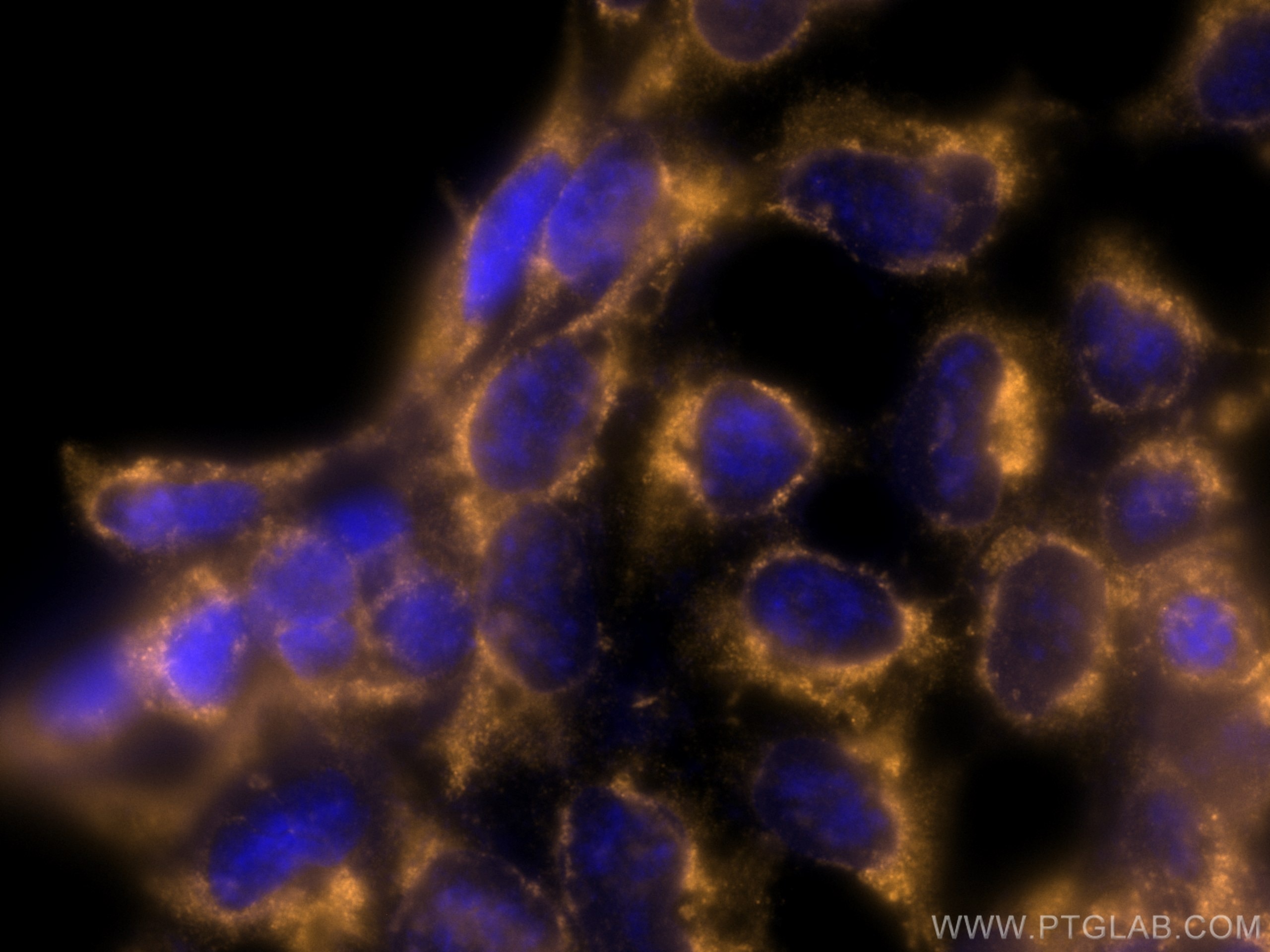 Immunofluorescence (IF) / fluorescent staining of HEK-293 cells using CoraLite®555-conjugated TPT1 Monoclonal antibody (CL555-66713)