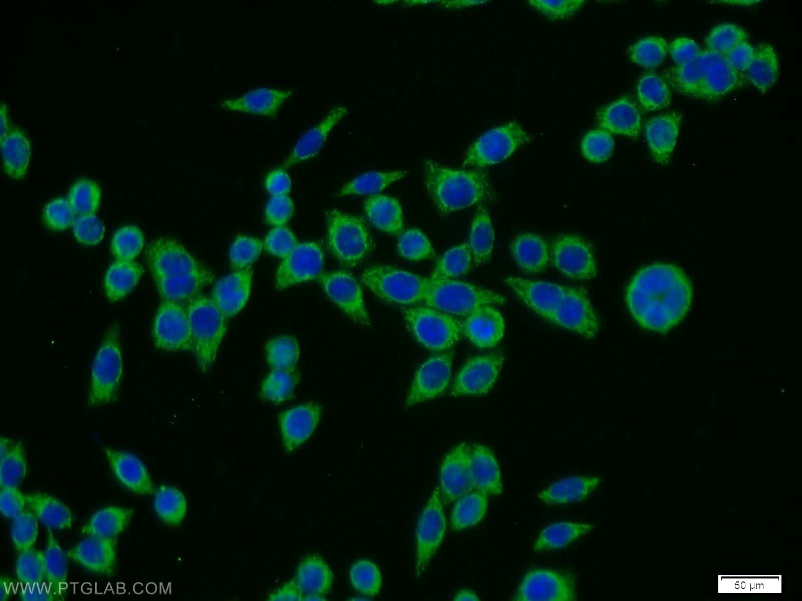 Immunofluorescence (IF) / fluorescent staining of BxPC-3 cells using TPTE Polyclonal antibody (12982-1-AP)