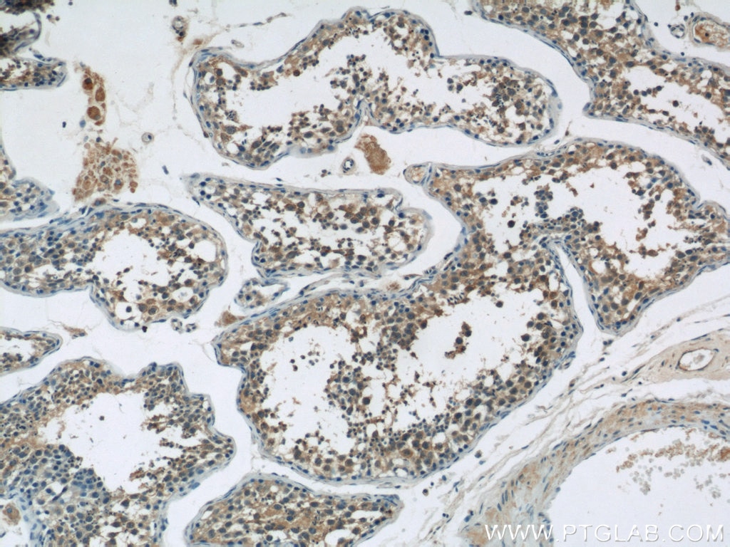 Immunohistochemistry (IHC) staining of human testis tissue using TPTE Polyclonal antibody (12982-1-AP)