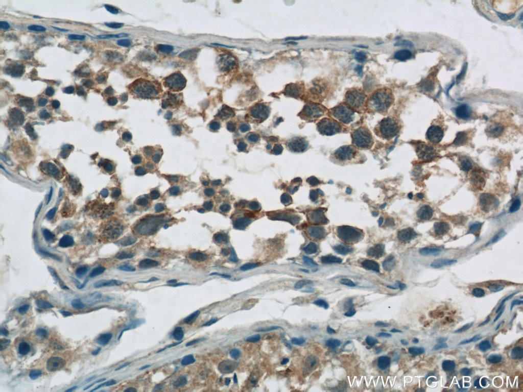 Immunohistochemistry (IHC) staining of human testis tissue using TPTE Polyclonal antibody (12982-1-AP)