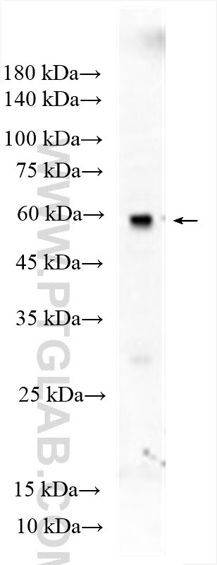 Western Blot (WB) analysis of mouse testis tissue using TPTE Polyclonal antibody (12982-1-AP)