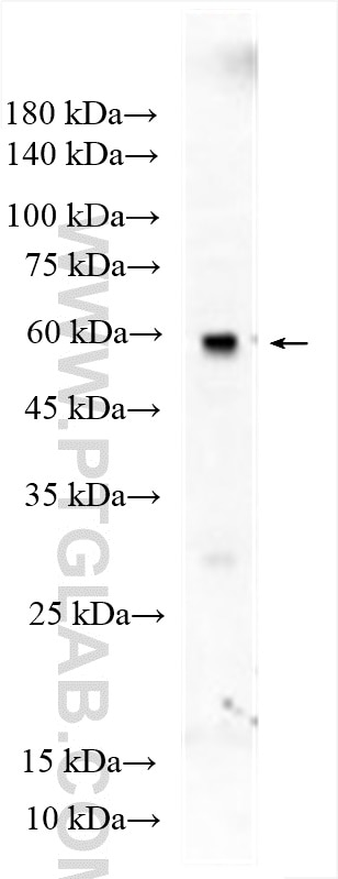 Western Blot (WB) analysis of mouse testis tissue using TPTE Polyclonal antibody (12982-1-AP)