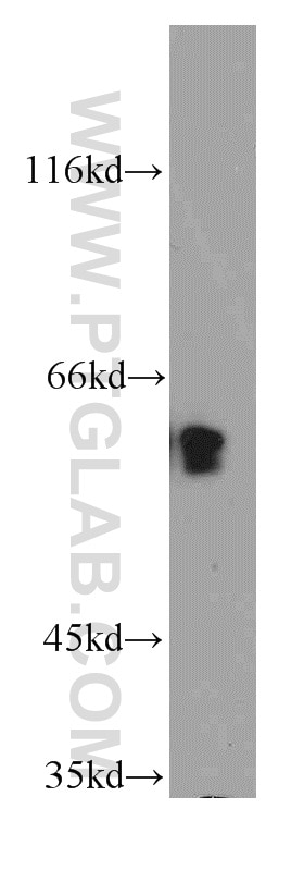 Western Blot (WB) analysis of HepG2 cells using TPTE Polyclonal antibody (12982-1-AP)