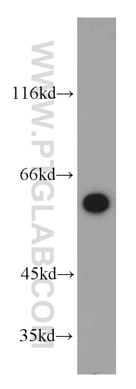 Western Blot (WB) analysis of HEK-293 cells using TPTE Polyclonal antibody (12982-1-AP)