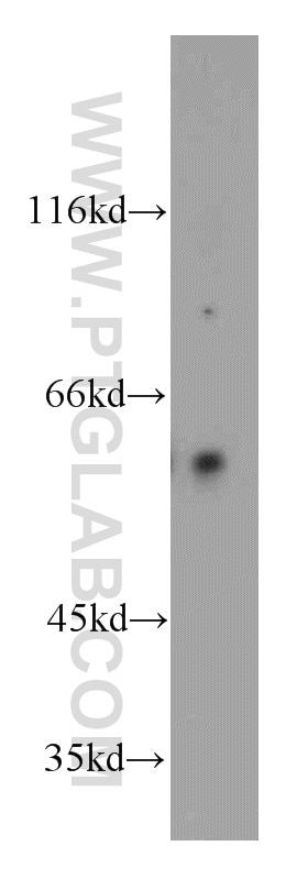 Western Blot (WB) analysis of HEK-293 cells using TPTE Polyclonal antibody (12982-1-AP)