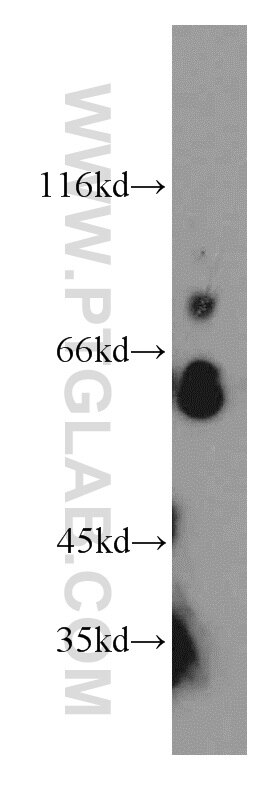 Western Blot (WB) analysis of human testis tissue using TPTE Polyclonal antibody (12982-1-AP)