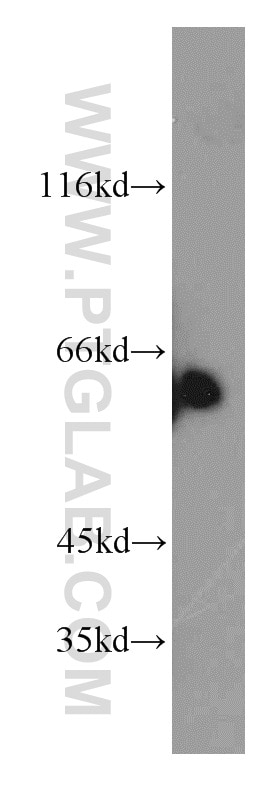 Western Blot (WB) analysis of human testis tissue using TPTE Polyclonal antibody (12982-1-AP)