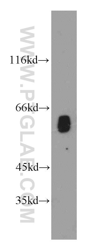 Western Blot (WB) analysis of BxPC-3 cells using TPTE Polyclonal antibody (12982-1-AP)