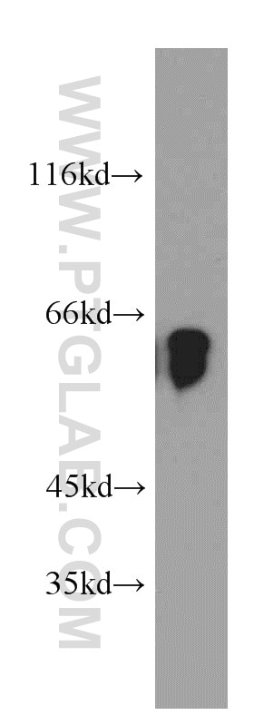 Western Blot (WB) analysis of BxPC-3 cells using TPTE Polyclonal antibody (12982-1-AP)