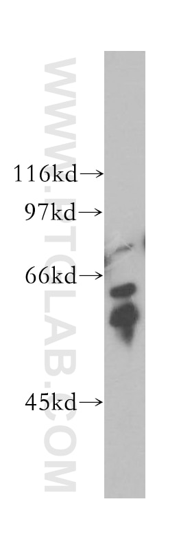 Western Blot (WB) analysis of HepG2 cells using TPTE Polyclonal antibody (12982-1-AP)