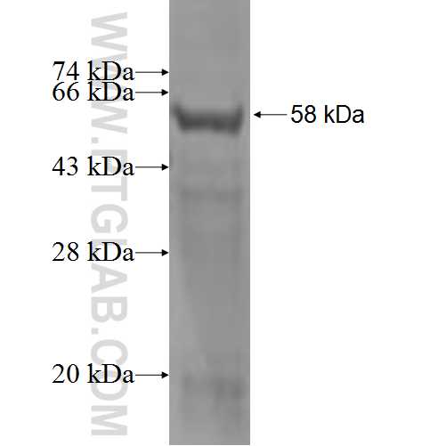 TPTE fusion protein Ag3606 SDS-PAGE