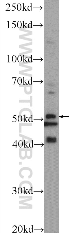 Western Blot (WB) analysis of L02 cells using TPTE2 Polyclonal antibody (25120-1-AP)