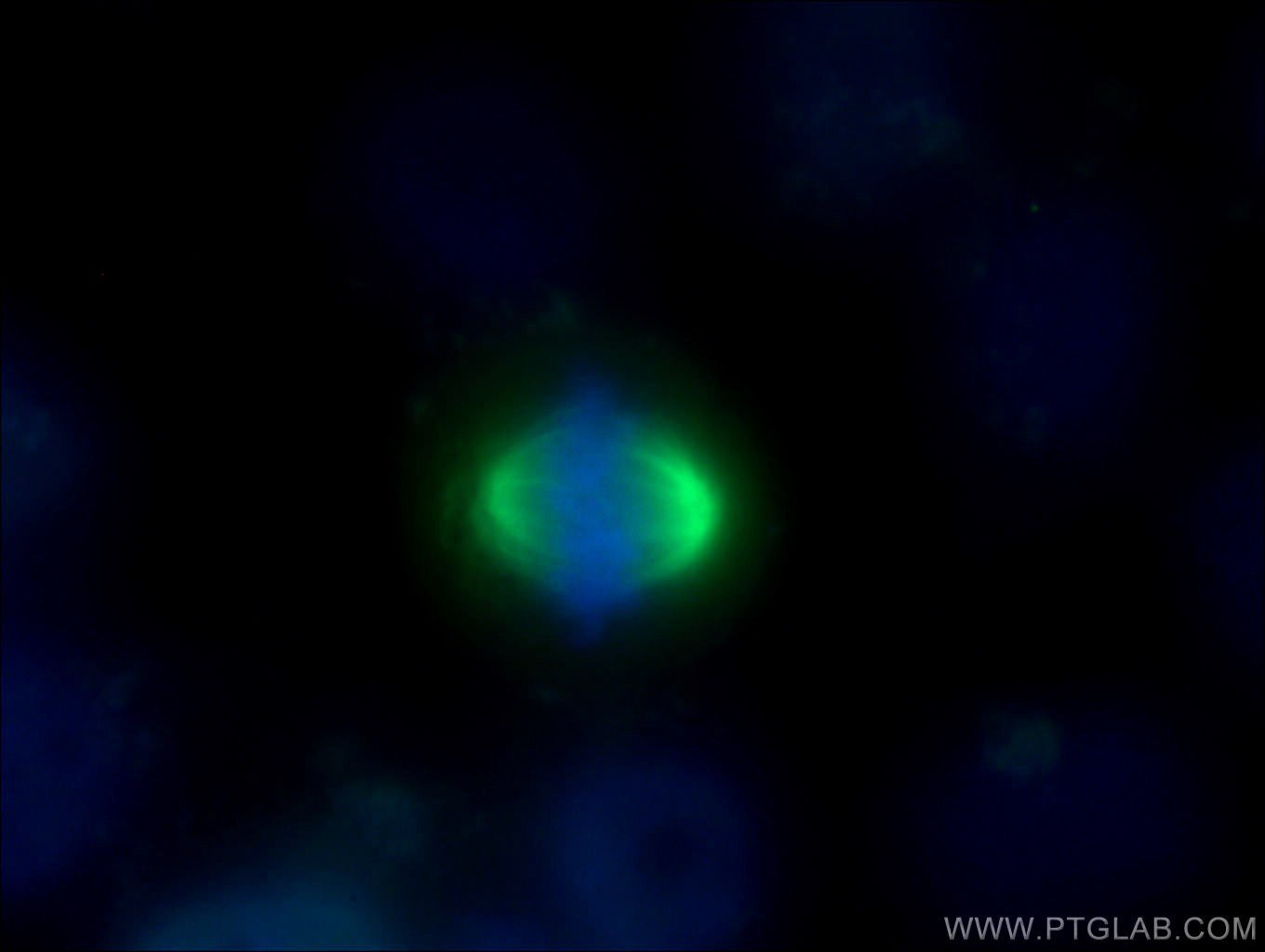 Immunofluorescence (IF) / fluorescent staining of HeLa cells using TPX2 Polyclonal antibody (11741-1-AP)