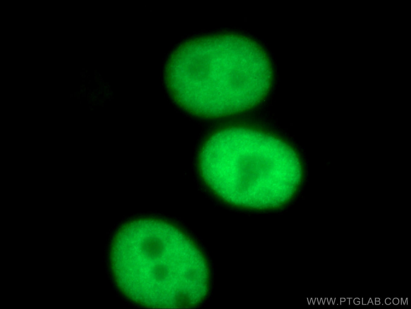 Immunofluorescence (IF) / fluorescent staining of HeLa cells using TPX2 Polyclonal antibody (11741-1-AP)