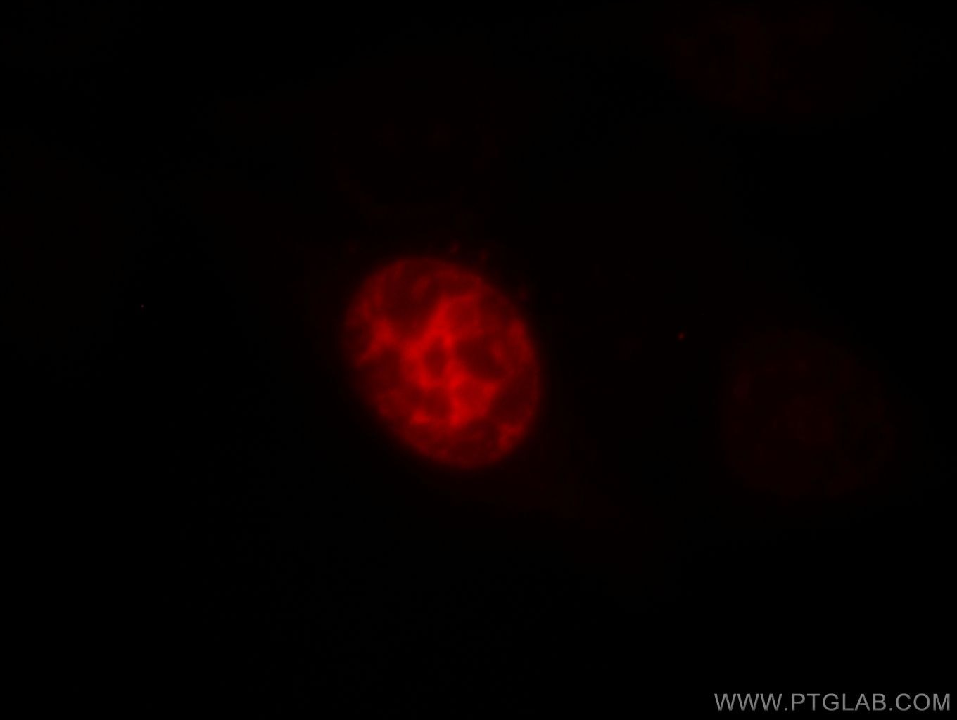 Immunofluorescence (IF) / fluorescent staining of HepG2 cells using TPX2 Polyclonal antibody (11741-1-AP)