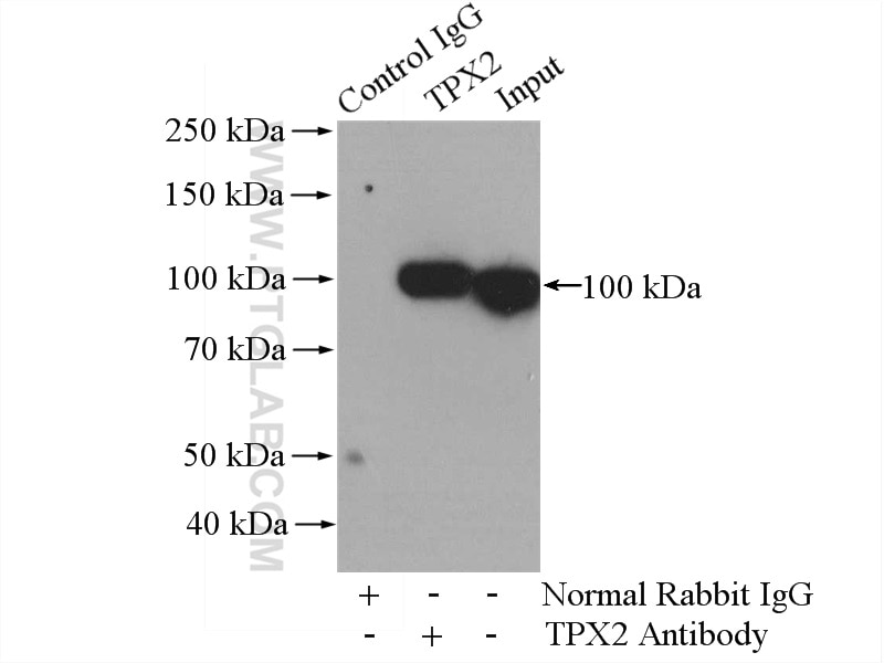 Immunoprecipitation (IP) experiment of HeLa cells using TPX2 Polyclonal antibody (11741-1-AP)