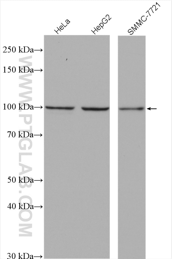 Western Blot (WB) analysis of various lysates using TPX2 Polyclonal antibody (11741-1-AP)