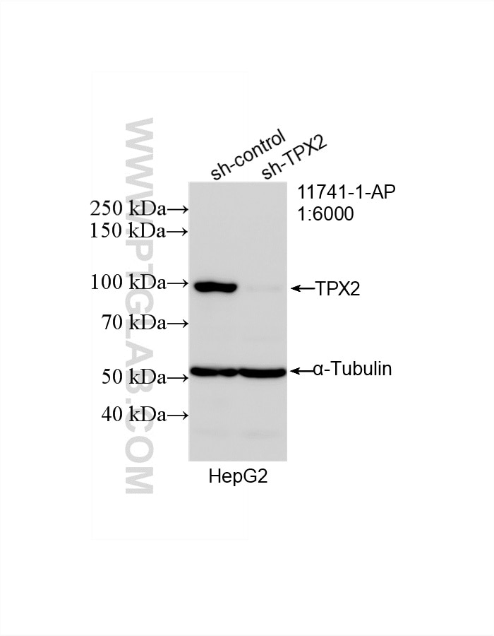 Western Blot (WB) analysis of HepG2 cells using TPX2 Polyclonal antibody (11741-1-AP)