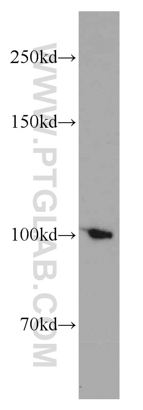 Western Blot (WB) analysis of K-562 cells using TPX2 Polyclonal antibody (11741-1-AP)