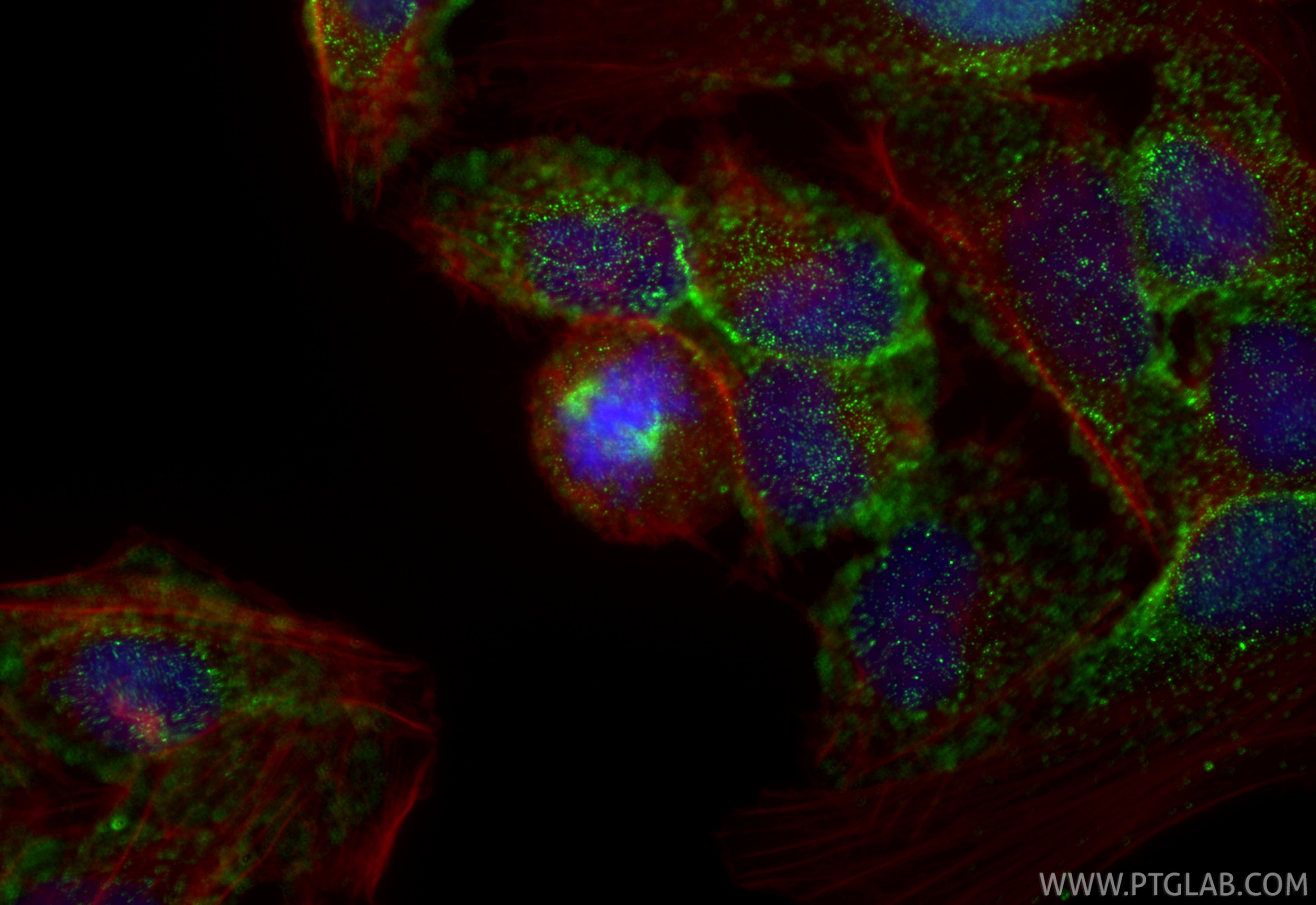 Immunofluorescence (IF) / fluorescent staining of U2OS cells using TPX2 Monoclonal antibody (68712-1-Ig)