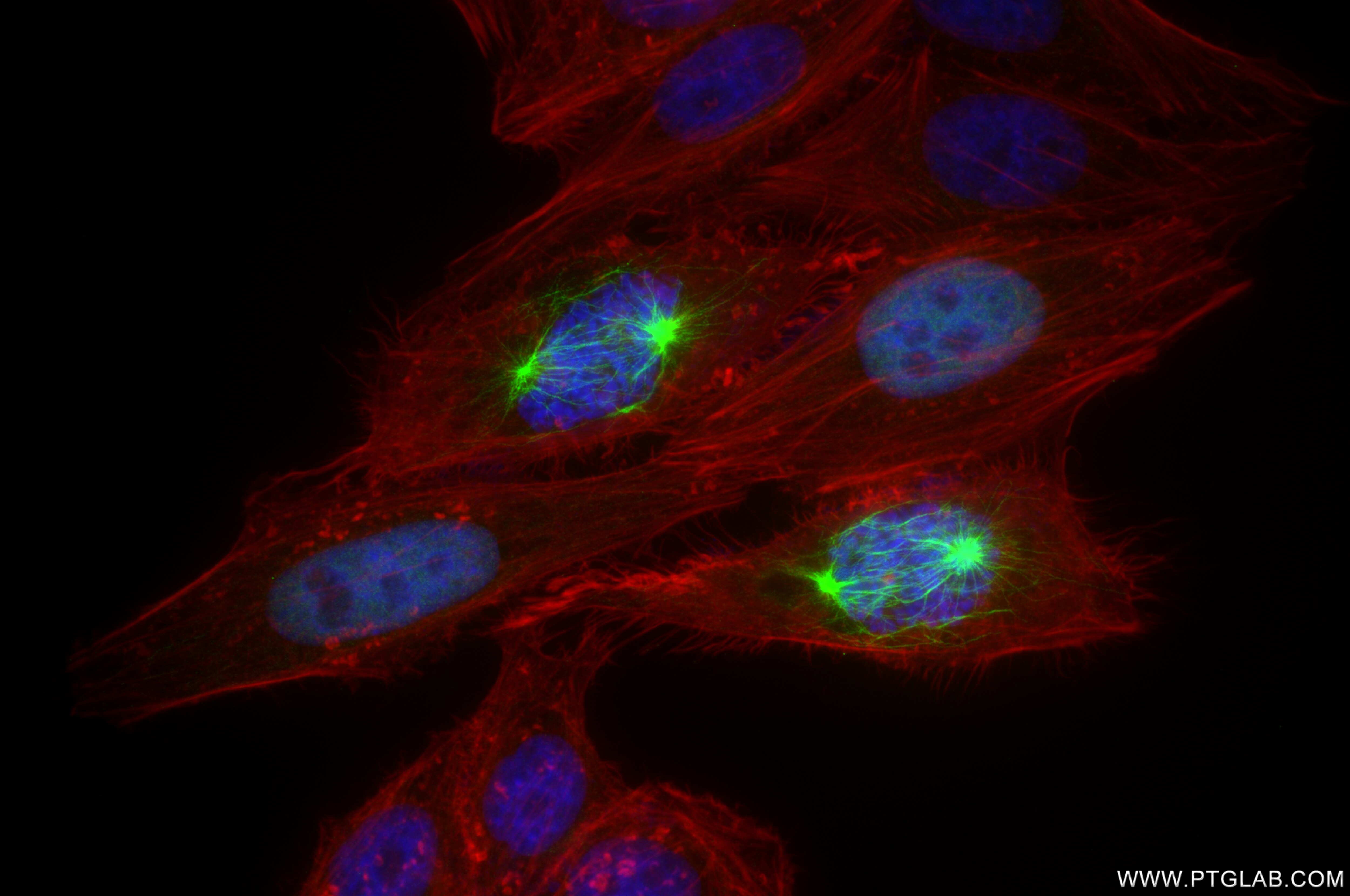 Immunofluorescence (IF) / fluorescent staining of HepG2 cells using TPX2 Recombinant antibody (85118-6-RR)