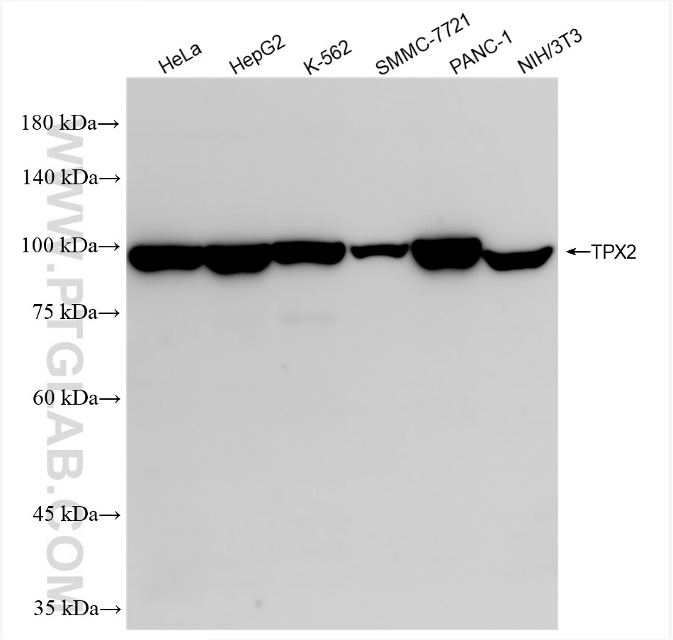 Western Blot (WB) analysis of various lysates using TPX2 Recombinant antibody (85118-6-RR)