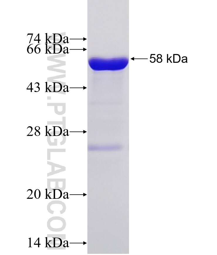 TPX2 fusion protein Ag33683 SDS-PAGE